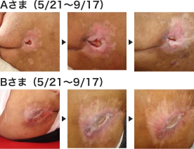 スーパーメディカルマット